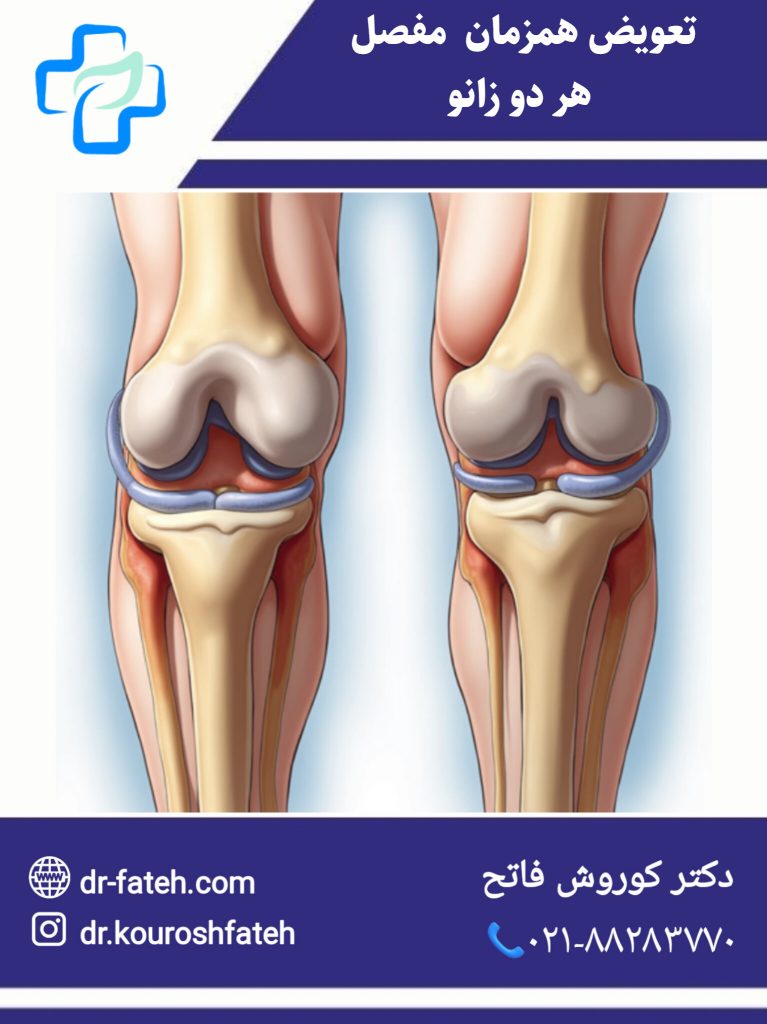 تعویض همزمان مفصل هر دو زانو