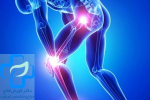 روش های حفظ سلامت مفاصل