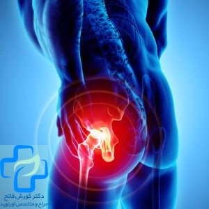 پروتز لگن چقدر عمر می کند؟