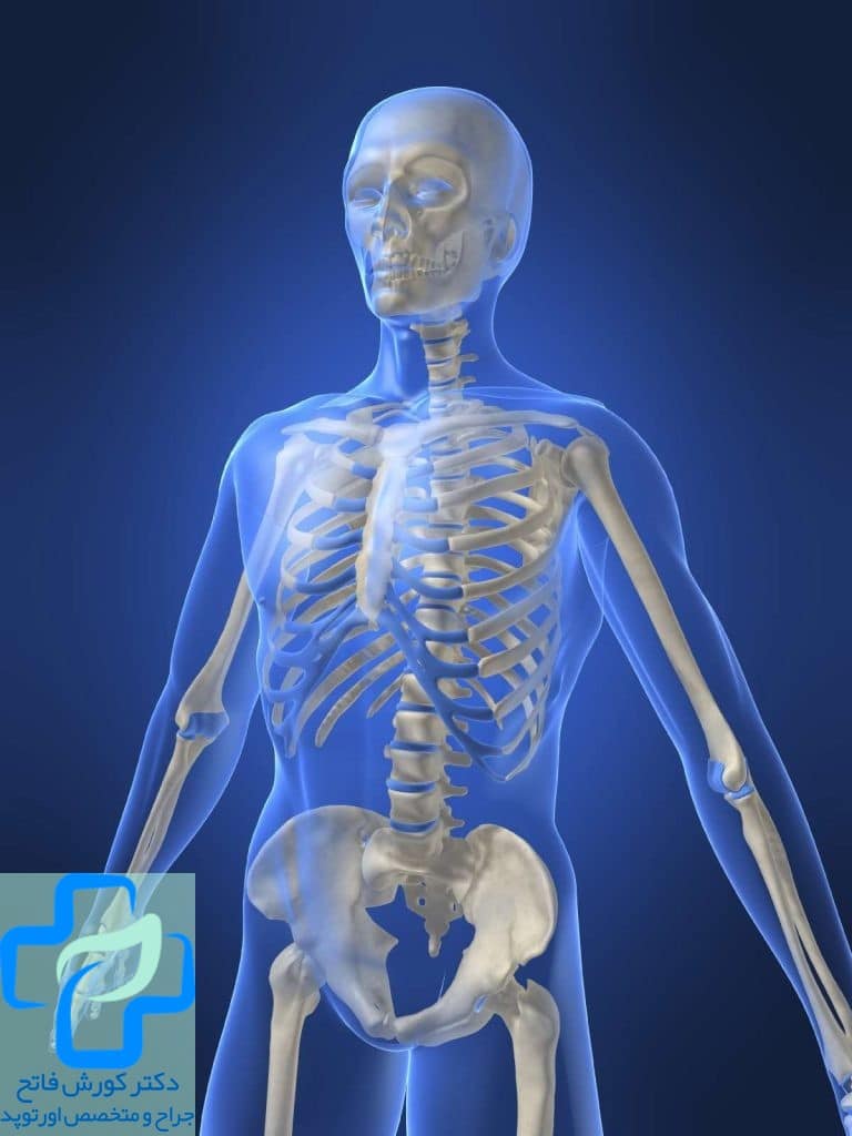 بیماری های شایع در ارتوپدی