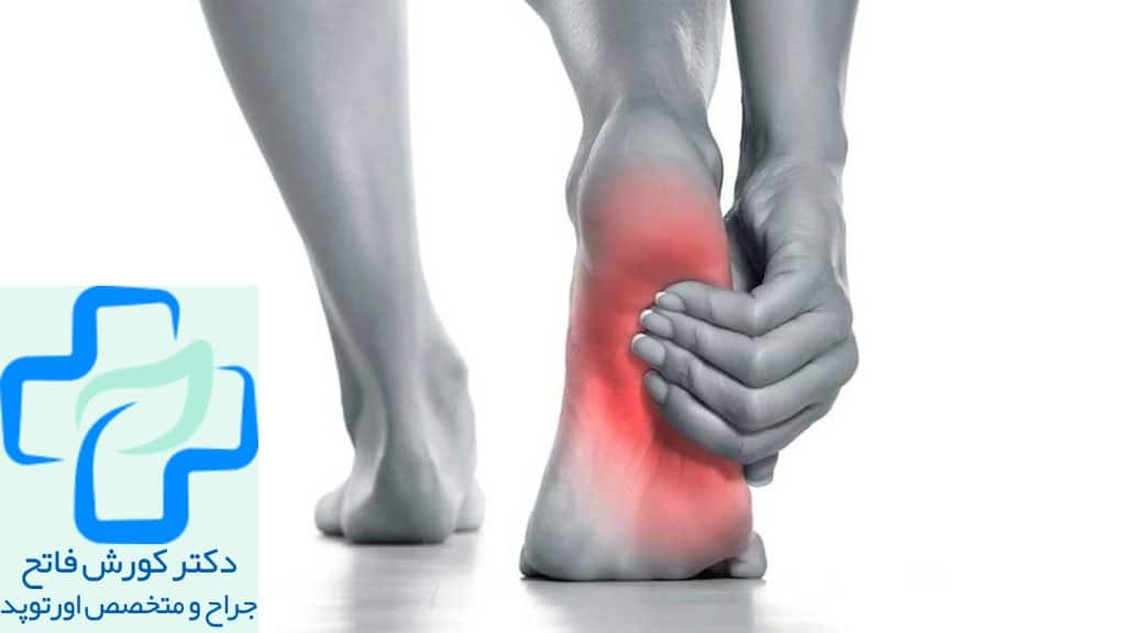 فاسیای کف پا